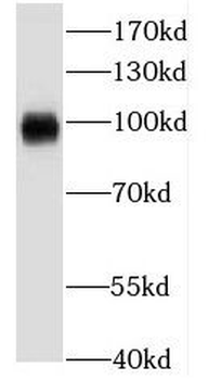 KCNC4 Antibody