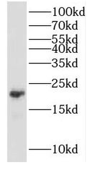 KCNE1 Antibody