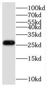 KCNE4 Antibody