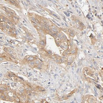 KCNIP1 Antibody