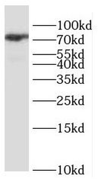 KCNJ1 Rabbit Polyclonal Antibody
