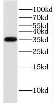 KCNJ15 Antibody