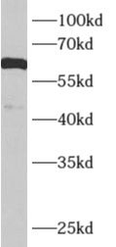 KCNJ3 Rabbit Polyclonal Antibody