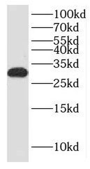 KCTD14 Rabbit Polyclonal Antibody