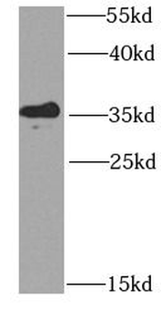 KCTD15 Antibody