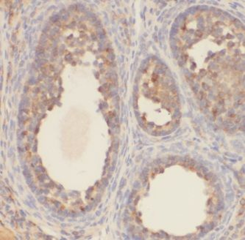 KCTD5 Antibody