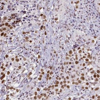 KDM1A Antibody