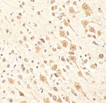 KDM2A Antibody