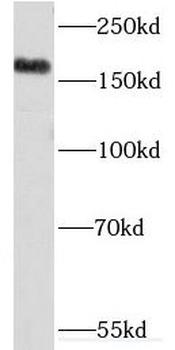 KDM5C Antibody