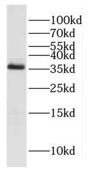 KDSR Antibody