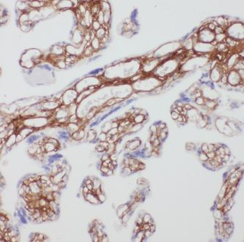 KDSR Antibody
