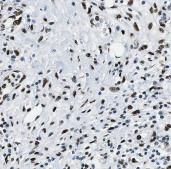 KEAP1 Mouse Monoclonal Antibody