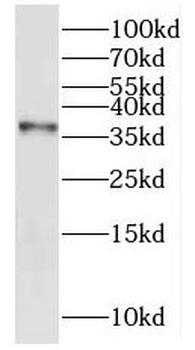 KHDC1 Rabbit Polyclonal Antibody