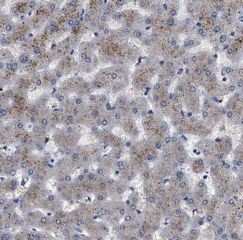 KHDC1 Rabbit Polyclonal Antibody