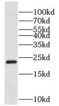KHDC3L Rabbit Polyclonal Antibody