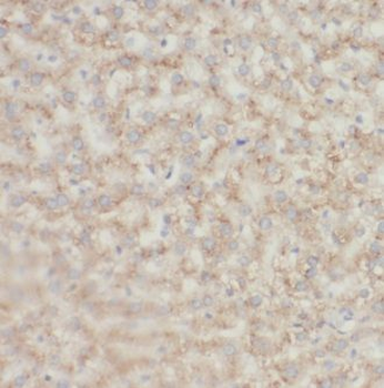 KHDC3L Rabbit Polyclonal Antibody