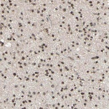KHDRBS3 Antibody