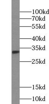 KHK Antibody