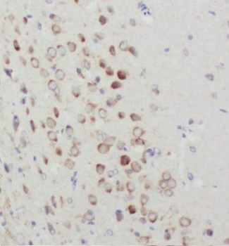 KIAA0319L Antibody