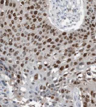 KHDC4 Antibody