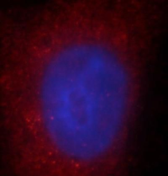 CEMIP Antibody