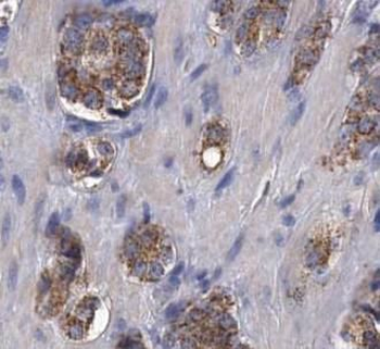 CEMIP Antibody