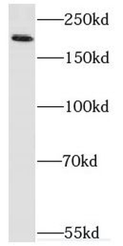 VIRMA Antibody