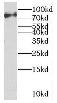 UVSSA Antibody