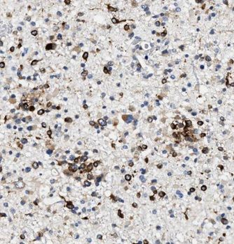 KIF17 Antibody