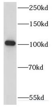 KIF18A Antibody