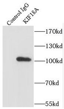 KIF18A Antibody
