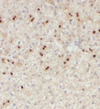 KIF18A Antibody