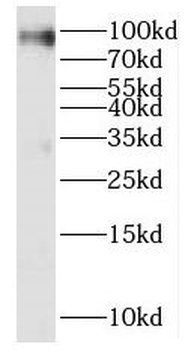 KIF19 Rabbit Polyclonal Antibody