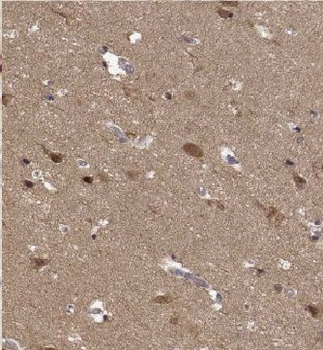 KIF19 Rabbit Polyclonal Antibody