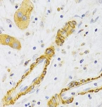 KIF1B Antibody