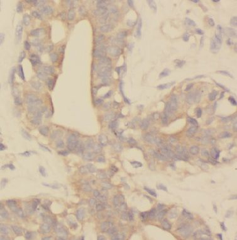 KIF2A Antibody