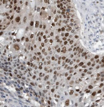 KIF4A Antibody