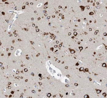 KIF5A Antibody