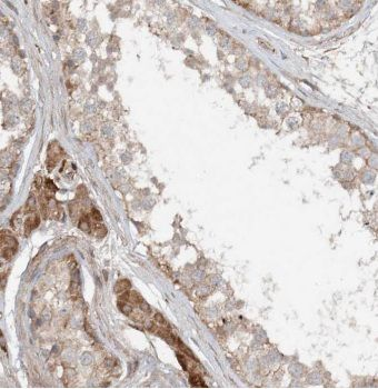KIF5C Antibody