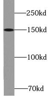 KIF7 Antibody