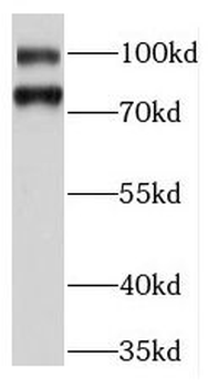 KIFC3 Antibody