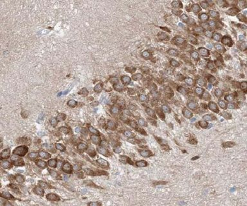 KCNJ2 Antibody