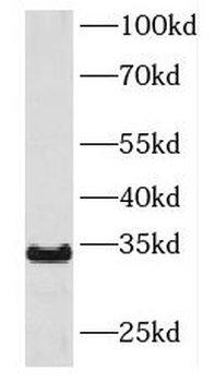 KIR2DS4 Antibody