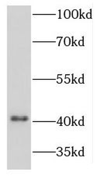 KCNJ10 Antibody