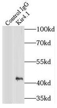 KCNJ10 Antibody