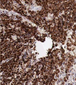 KCNJ10 Antibody