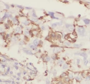 KISS1 Antibody