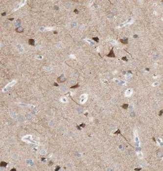 KLC2 Rabbit Polyclonal Antibody
