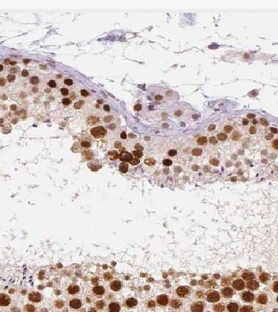 KLHDC3 Antibody