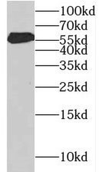 KLHDC4 Antibody